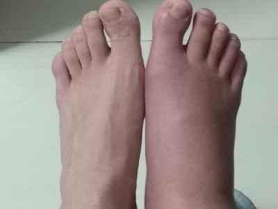 篮球防守技巧（以打篮球防守为例，探讨捏脚是否合乎规则和道德。）