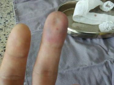乒乓球中黑点的奥秘（揭开乒乓球内黑点的神秘面纱，了解其影响与由来）