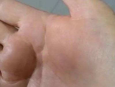 乒乓球粘连修复的技巧与方法（让你的乒乓球拍像新的一样！）