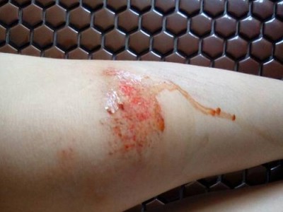 篮球防守中撞到膝盖疼痛的常见问题及应对措施（探索篮球防守中撞到膝盖疼痛的原因，帮助球员避免伤害）